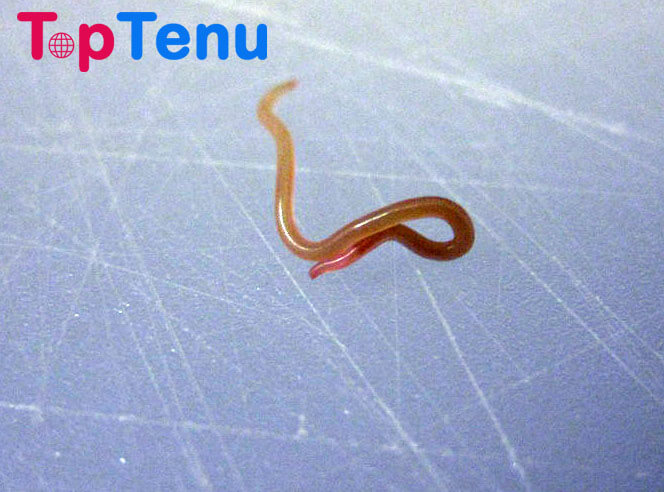 Top 11 Worst Parasites in the Water